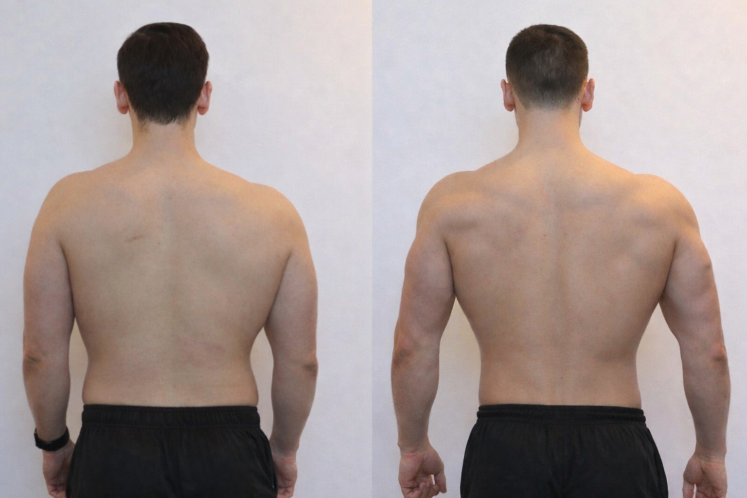 artur back before and after